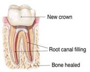 Endodontic Specialist of Oakhurst